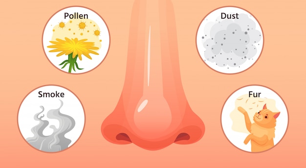 Аллергическая болезнь. Красный нос, симптомы аллергии и аллергены. Иллюстрации шаржа аллергии дыма, пыльцы и пыли