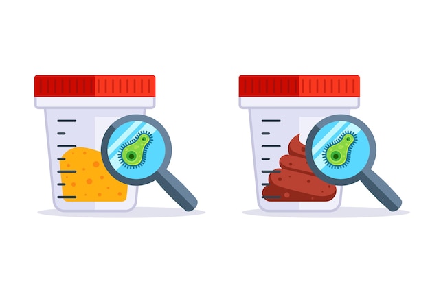 Analyse van urine en uitwerpselen op ongedierte. positieve test voor schadelijke microben. platte vectorillustratie.