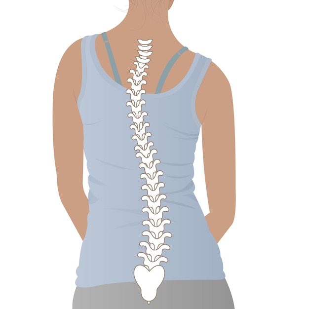 Vector anatomy of curvature of the spine in scoliosis posture correction