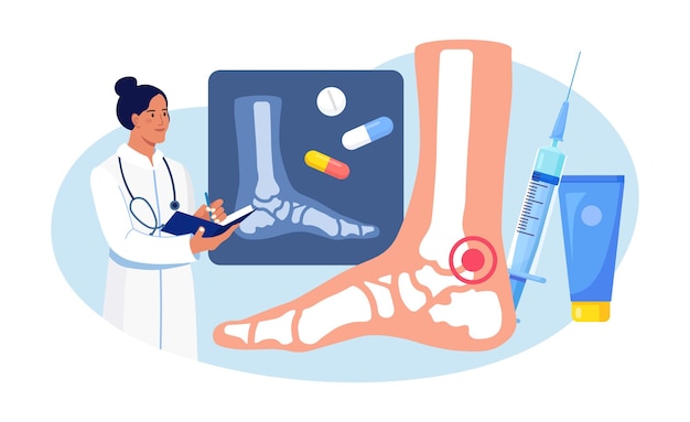 Vector ankle foot arthritis. doctor examining xray pictures of joints. osteoarthritis, rheumatoid arthritis, rheumatism disease. physician treat patient joint pain