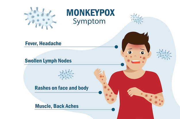 Apenpokkenvirus symptoom infographic bij patiënt met koorts hoofdpijn gezwollen lymfeklier uitslag op gezicht