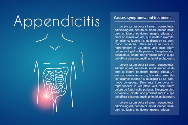Appendicitis linear icon on blue background. Vector illustration of young man with red spot on his tummy suffers from inflammation of appendix. Design template for medicine or therapy for appendicitis
