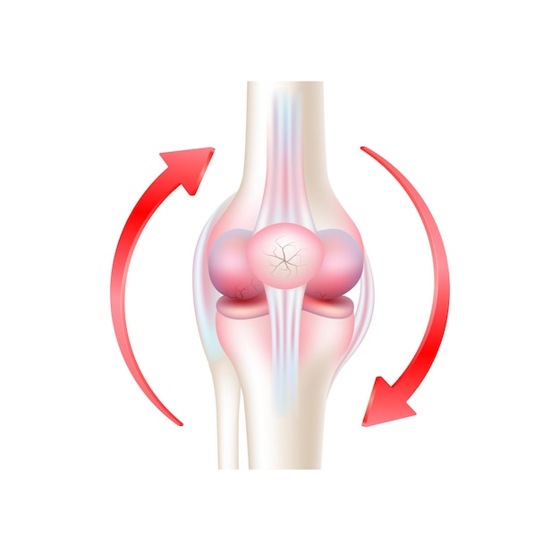 관절염 뼈와 주위에 원형 빨간색 화살표에 고립 된 흰색 배경. 제품 템플릿 디자인입니다.