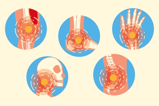 Arthritis joint pain syndrome set