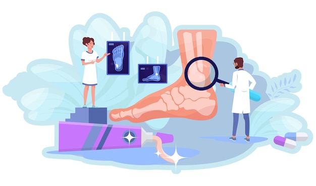 Artritis aan de voet. röntgenscan. gewrichtsziekte dostor onderzoekt voet met een gigantisch vergrootglas. kleine dokters