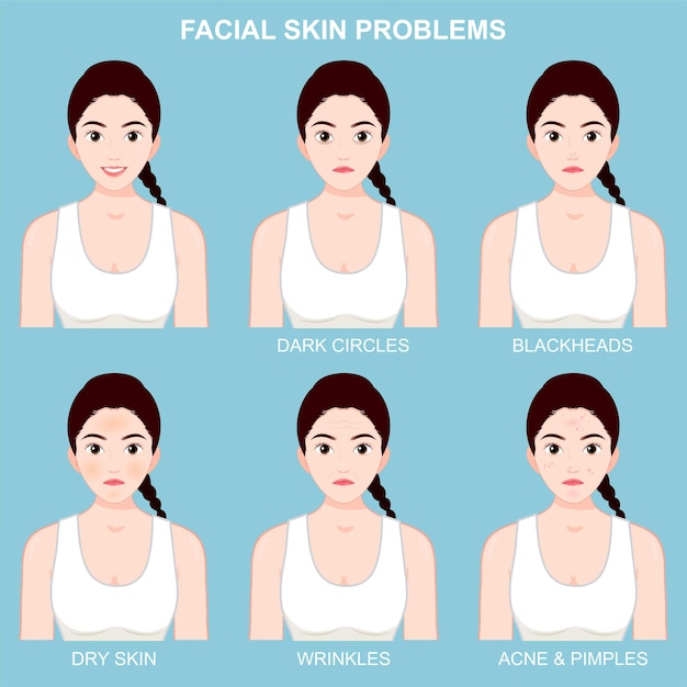 Asian girl skin problems light skin nature beauty skincare
