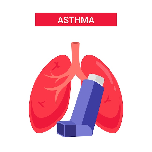 Astma vector, vlakke stijl long ontwerp illustratie