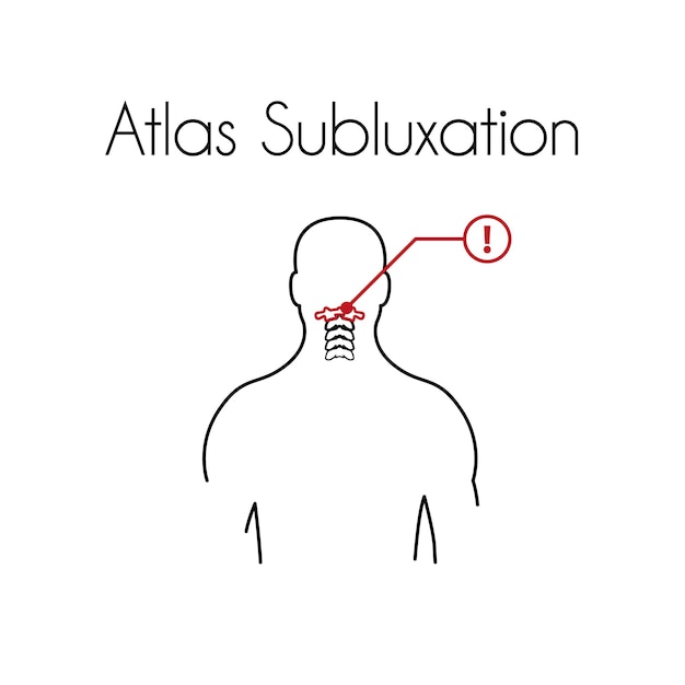 Atlas subluxation linear design template for medicine or therapy for rachiocampsis or backache