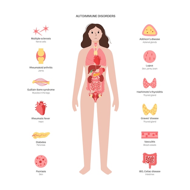 Vector autoimmune disorders diseases