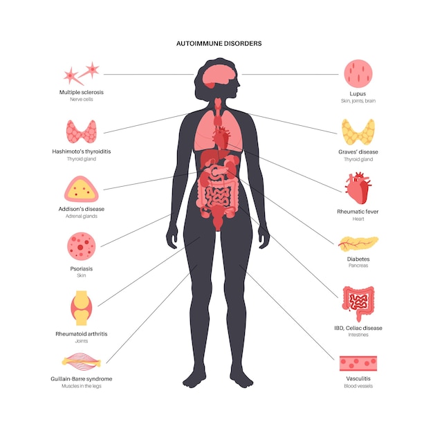 Vector autoimmune disorders diseases