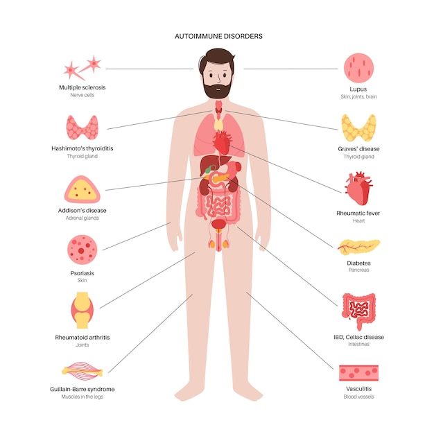 Vector autoimmune disorders diseases