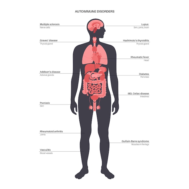 Vector autoimmune disorders diseases