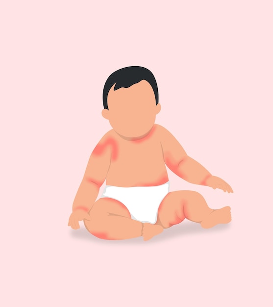 a baby boy has a rash all over his body