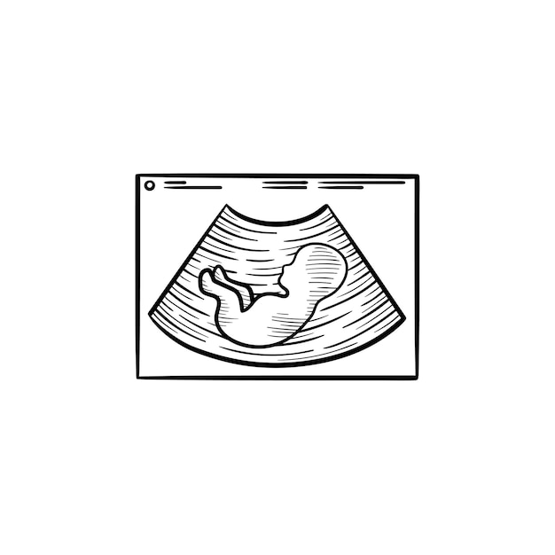 Baby silhouet op echografie hand getrokken schets doodle pictogram. Zwangerschap echografie met een baby erop schets vectorillustratie voor print, web, mobiel en infographics geïsoleerd op een witte achtergrond.