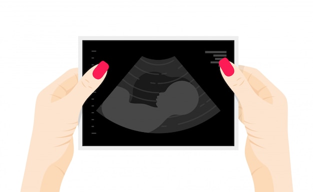 Foto di ecografia del bambino nell'illustrazione piatta delle mani della donna. sagoma del feto nel grembo materno, ecografia diagnostica di gravidanza o concetto di ecografia isolato su priorità bassa bianca