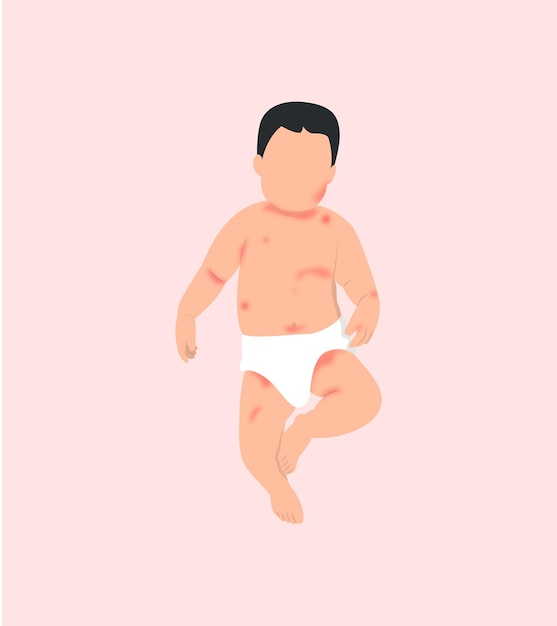 baby with a rash on the skin