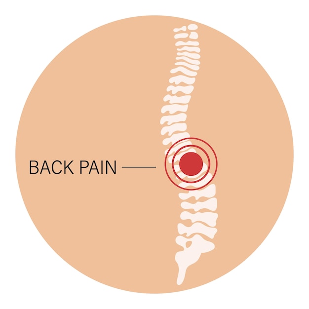 Dolore alla schiena dolore alla colonna vertebrale osteoartrite artrite reumatoide anatomia delle ossa umane medicina