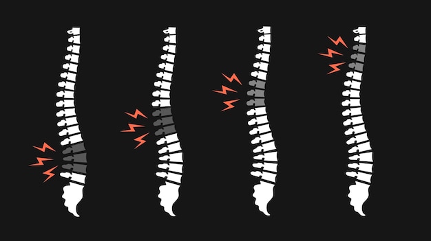 Vector back pain vector icon illustration isolated on black. backache spines set. damaged disks