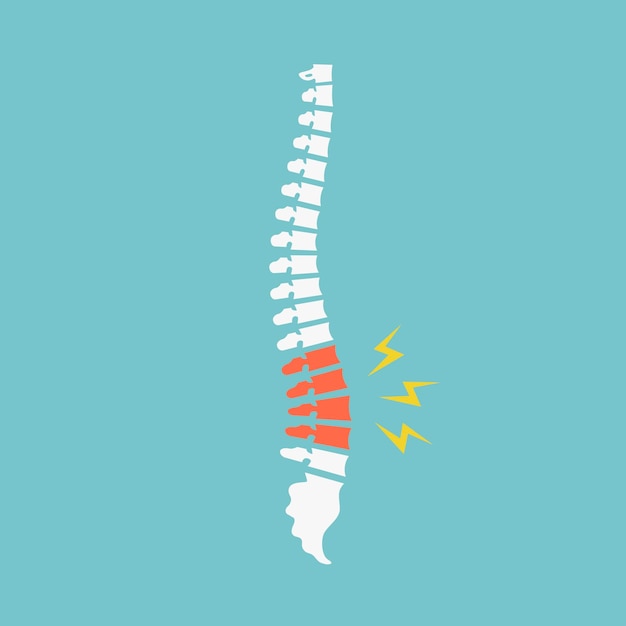 Боли в спине. иллюстрация вектора боли в спине выделена на синем фоне. поврежденные диски