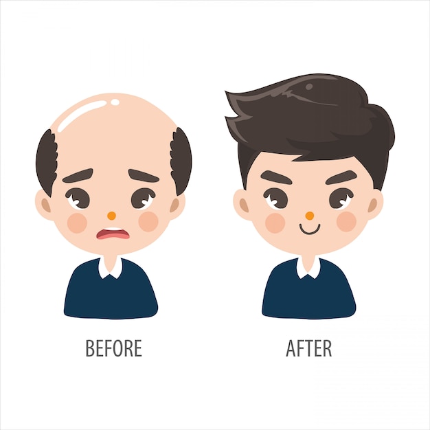 Vector bald man without confidence and long hair men look more handsome.