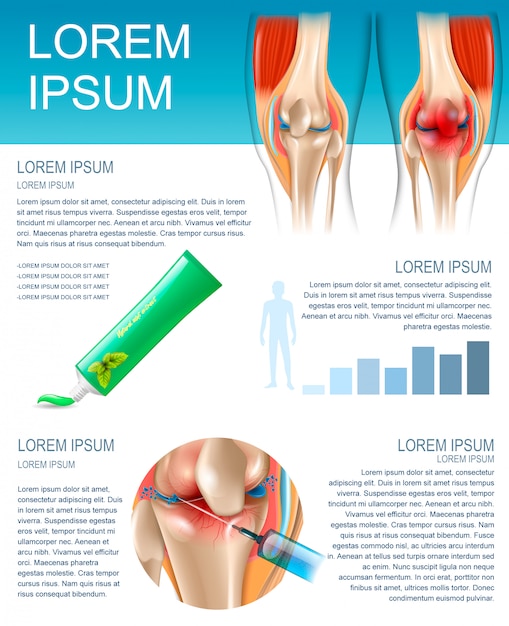 Banner infographics metodi di trattamento del dolore al ginocchio