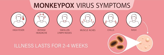 A banner with the monkey pox virus to inform and warn about the symptoms of the monkeypox