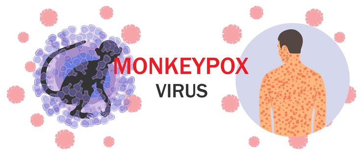 Vector 원숭이 수두 바이러스 세포 원숭이 실루엣 텍스트와 미생물학에 발진이 있는 인체가 있는 배너