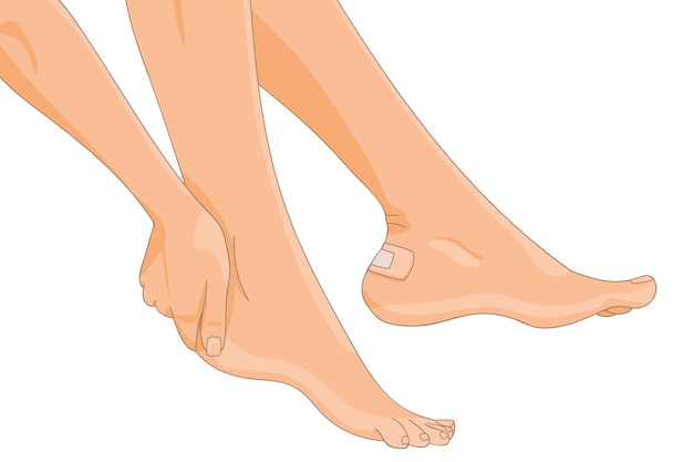 한쪽 발 뒤꿈치에 물집 석고가 적용된 벌거 벗은 여성 다리 측면보기 의료 스트립 붕대