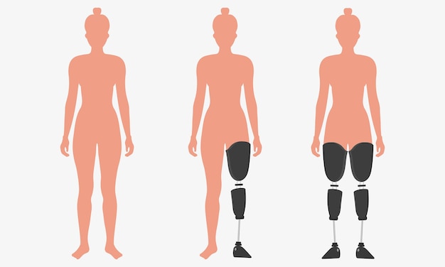 Beenen Prothese Limb vrouw Prothese kunstmatige been voor