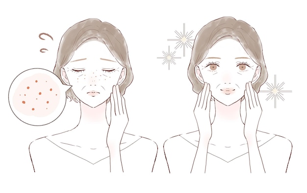 before and after of middle-aged women suffering from sebum pores. on white background.