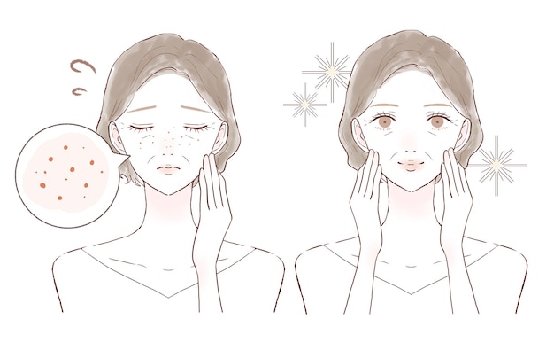 Before and after of middle-aged women suffering from sebum pores. On white background.