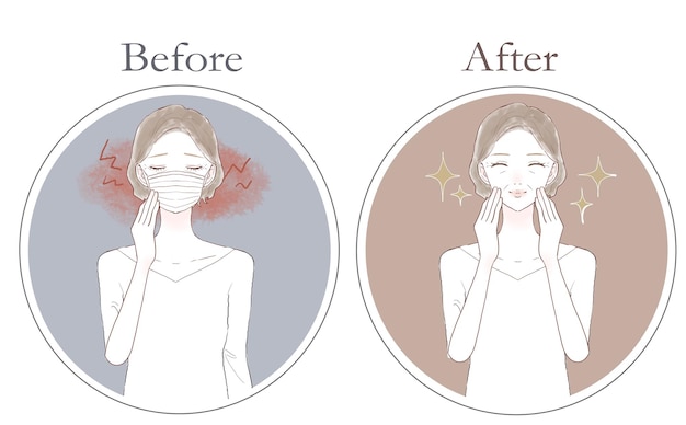 ベクトル マスク着用による摩擦や炎症に悩む中年女性の前後。白い背景に。