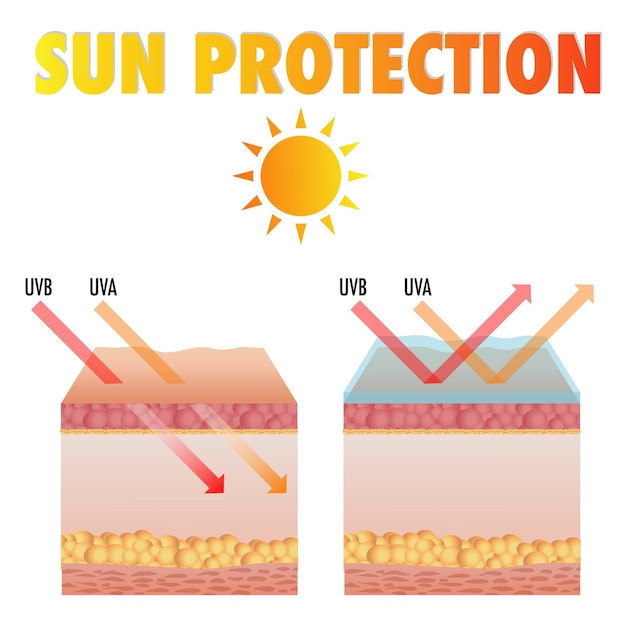 Bescherming van de huid tegen de zon. Beschadigde menselijke huid schilfert voor en na zonbescherming lichaam vetlagen ep