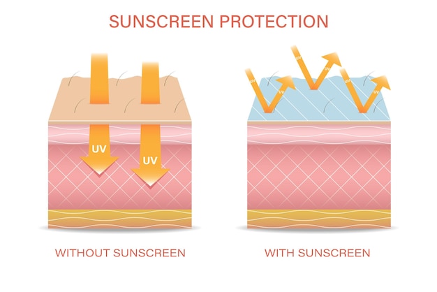 Bescherming van de huid tegen ultraviolette straling vectorillustratie