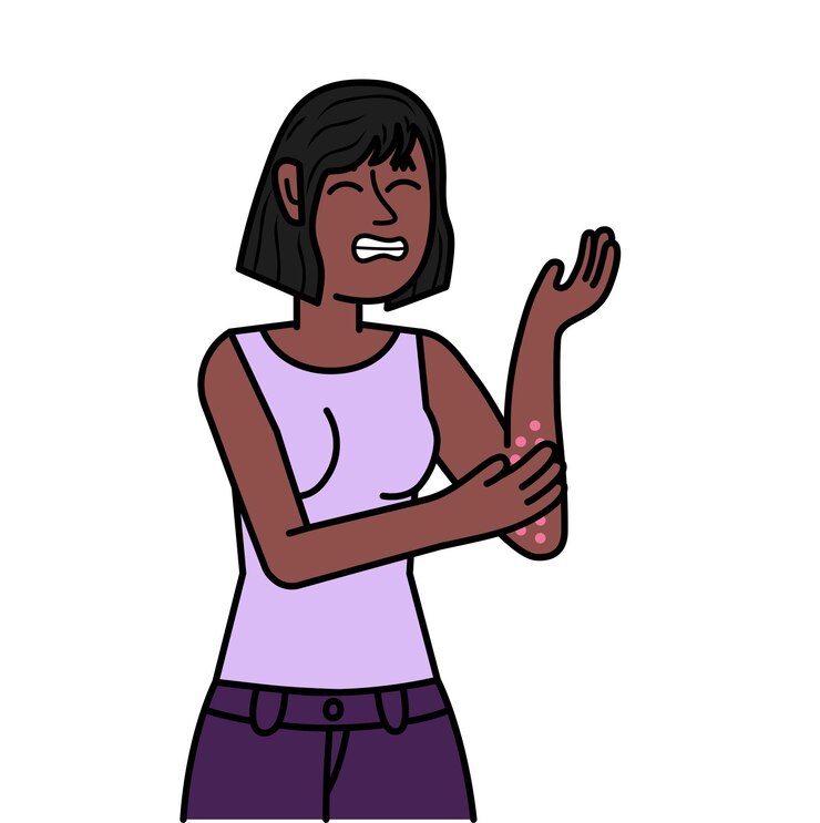 वेक्टर black woman with allergy scratching her hand