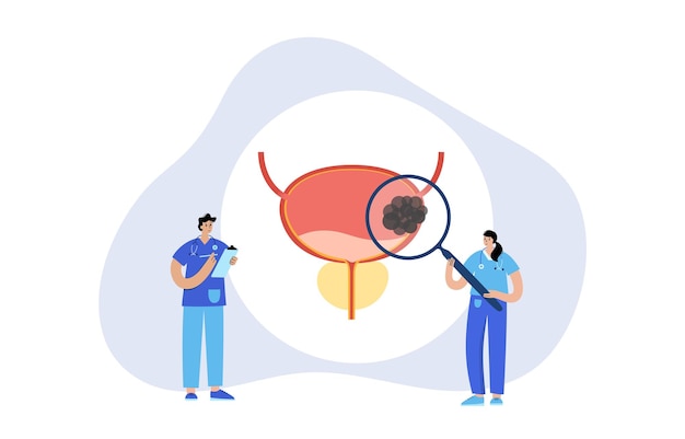 Bladder cancer stages