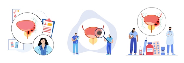 Bladder cancer stages