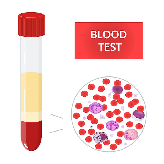 bloedanalyse in reageerbuizen en samenstelling van bloed onder microscoop