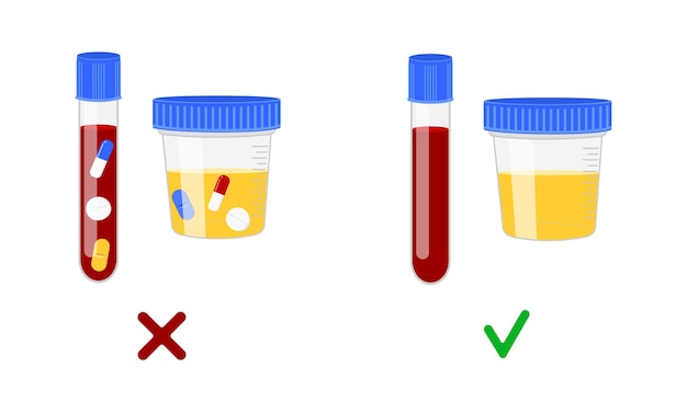 Вектор Образцы крови и мочи с различными препаратами и без них концепция допинг-контроля