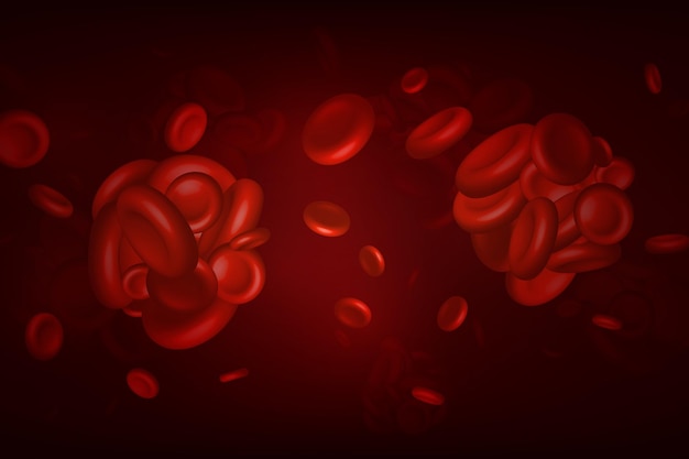 Blood clots thrombus or embolus with coagulated erythrocytes