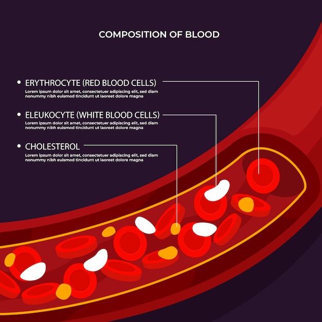 Infografica di sangue in design piatto