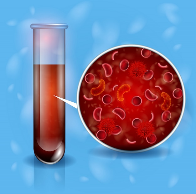 blood of sick human realistic vector concept