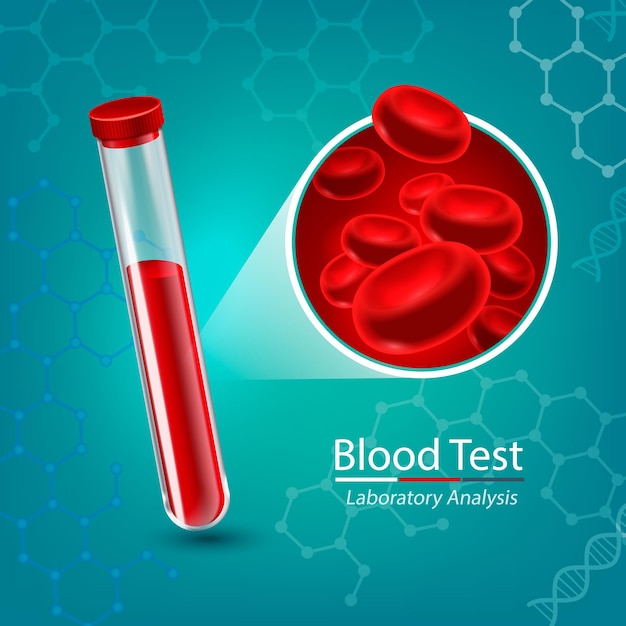 의료 테스트 튜브 일러스트와 함께 혈액 검사 구성