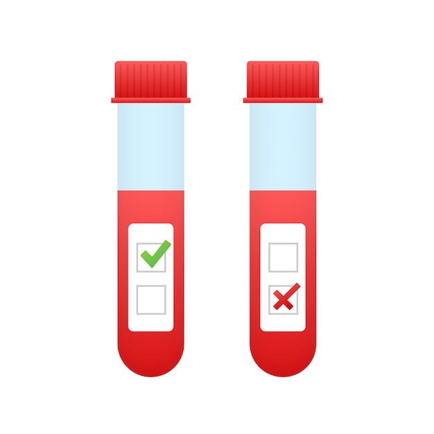 Risultato dell'analisi del sangue in stile piatto. ricerca di laboratorio chimico.