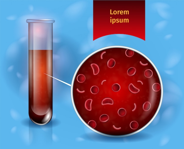 blood test vector concept 