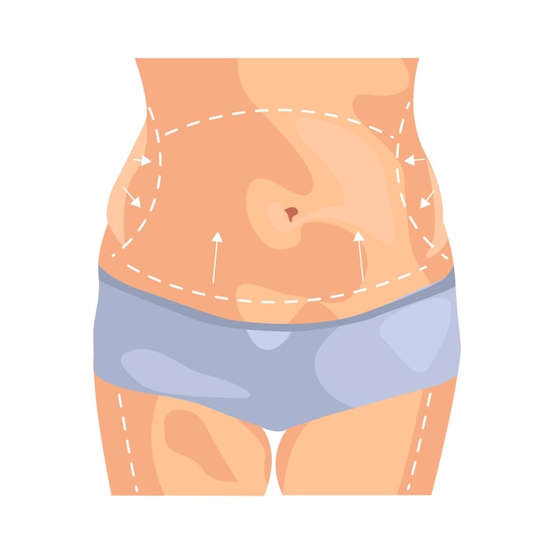 body correction illustration in color cartoon style editable
