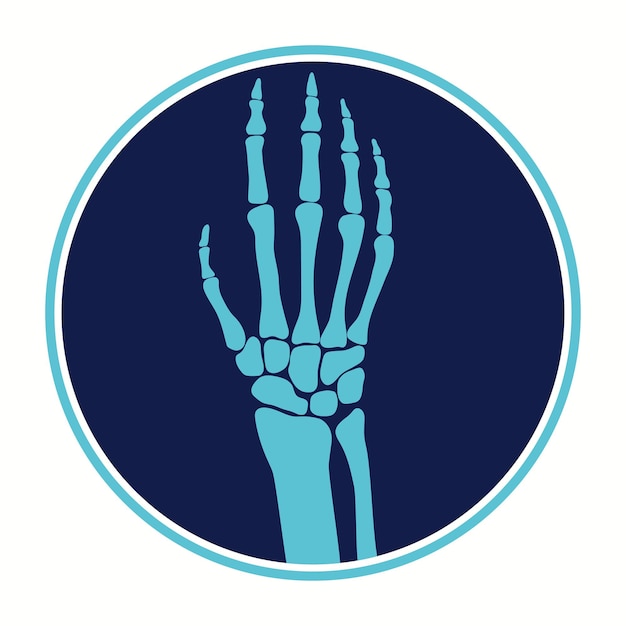 Кости руки. часть человеческого скелета. медицинская подробная иллюстрация. вектор