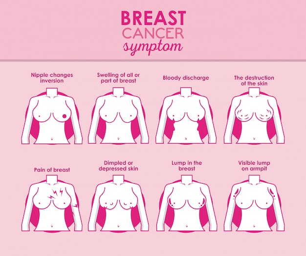 Vector borstkanker infographic