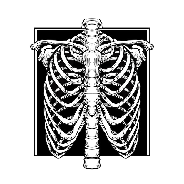 Vector borstkas zwart