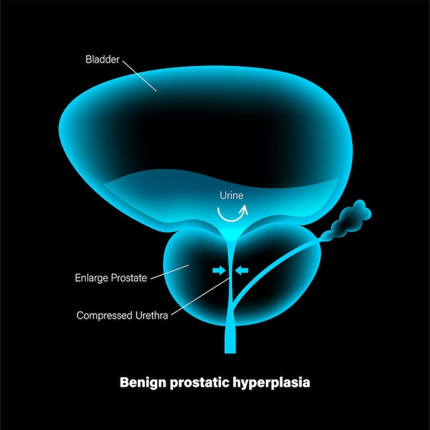 Vector bph info concept